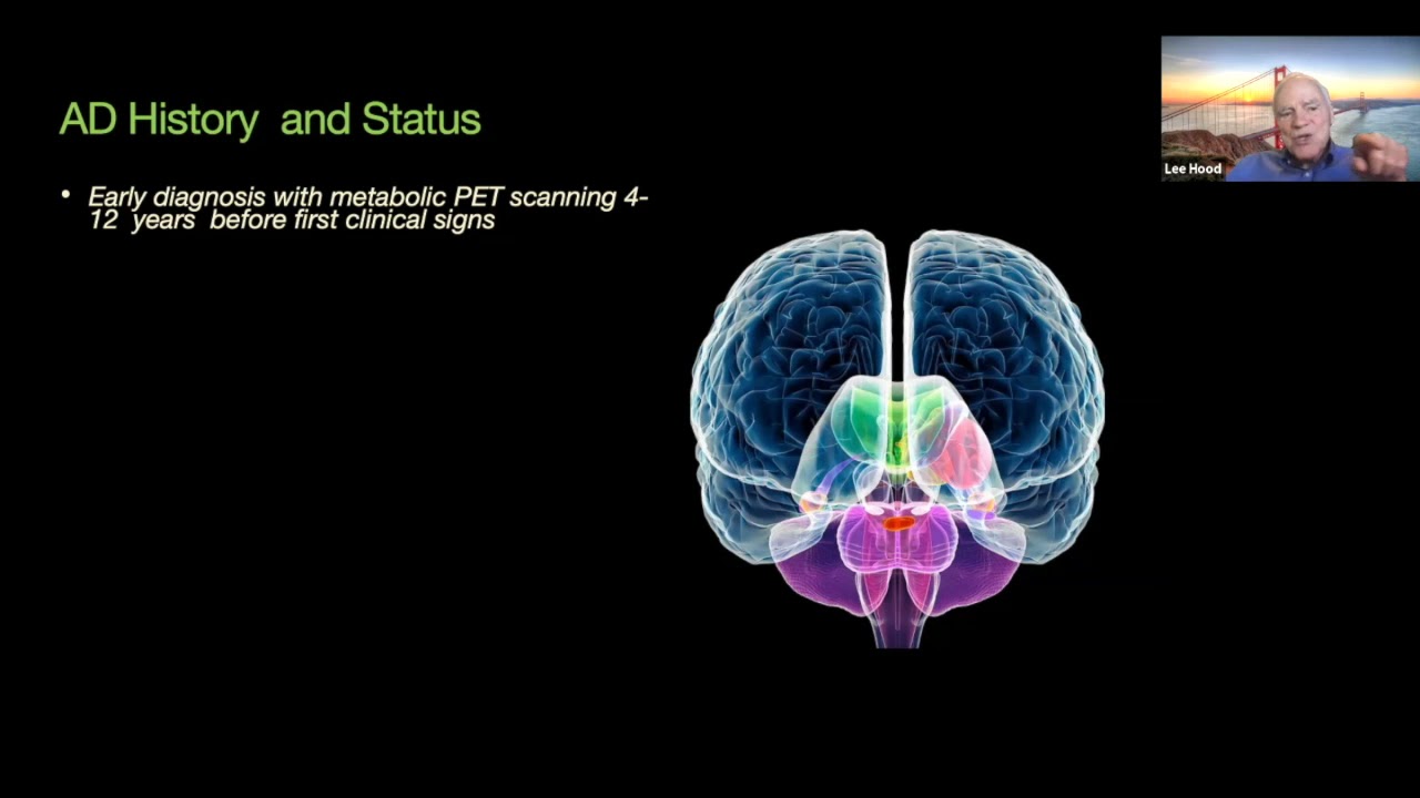 Approach Sb A New Approach to Alzheimer’s Disease - Hood Lab